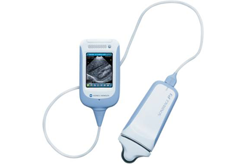 携帯型超音波画像診断装置